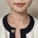 [대구 중구 플라즈마에스테틱] 대구콜드플라즈마 시술 후기 : 2주차 변화와 느낀점