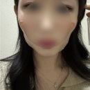 마라의샘 | 샘킴의원 달걀주사 내돈내산 후기
