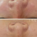 인동15길-2 이미지