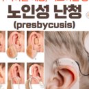 안경닥터 보청기 이미지