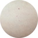 까치사우나 | 신사역 피부과 종아리 보톡스 200유닛 5일차｜근육형 효과, 부작용, 통증 솔직 후기