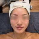 나도 바이오(NADO bio) | [청주 스킨스토리] 바이오필링 청주피부관리 미백 트러블관리 | 뉴알개 바이오필링 짱 좋다!