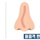 만곡 이미지