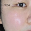 유미스트