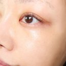 보나메두사 bonamedusa &#39;베스트 후기&#39; 자극받은 피부, 붉은기 진정시키기 레드 페이스 딜리트