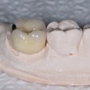 탑치과기공소 이미지