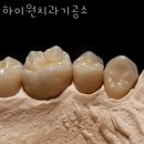 하이원치과기공소 | 금천구 가산동 치과 하이원치과기공소 위치 오는길 후기