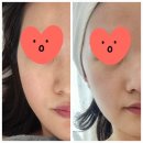 강서구 마곡피부관리 피부정원 에스테틱 베몽테스 민감성케어