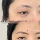 다움스킨 이미지