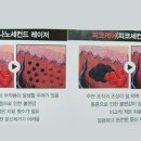 피코메드 이미지