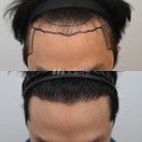 모엠의원 Daum카페