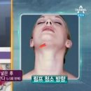 엣지마사지 네이버블로그
