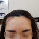라인헤어 이미지
