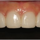 수플러스치과기공소 이미지