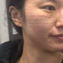 리즈 | 대구동성로스킨부스터 리즈네 후기