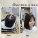 라인아파트(여자)경로당 | 중간가르마가 휑해요! 정수리부분가발후기 부산여자정수리가발