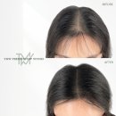 탈모왕수원 이미지