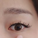 머물다 | 중동역 피부 맛집 스무살에머물다 비립종 케어 후기 ㅎㅎ