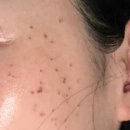 구로 끗한의원 이미지