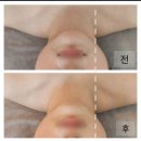 [은평구 구산동] 셀럽뷰티어겐 | 한방관리 솔직 후기