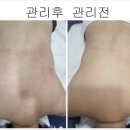 테라톡스 이미지
