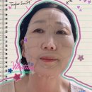 엘핌스 | 갈바닉 마스크팩 후기