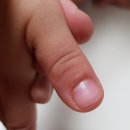 주식회사 엠조이 | 발뒤꿈치굳은살 각질제거기 - 엠조이