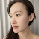 송파 피부관리 루미나에스테틱 수분 진정 LDM 물방울 잠실에스테틱 후기