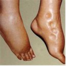 마사지 림프 요법 - 근육 관리 중요성 이미지