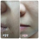물광+물광 광뿜 시리즈! 르아밍 미스트/벨르랑코 물광패드 OPEN