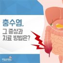 장염으로 착각 쉬운 맹장염, 빠른 수술이 중요 이미지