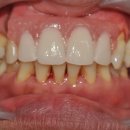 이레치과기공소 이미지