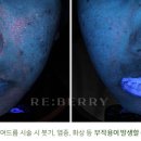 리베리의원 화성병점 이미지