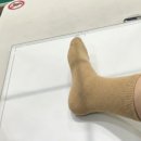 주  정형외과 | 부산 정형외과 발바닥 염증 치료 과정 비용 후기