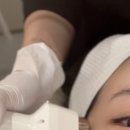 아이비에스테틱 | 물광관리와 리프팅효과 좋은 수영하이푸 수영리프팅 • 오비오에스테틱