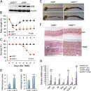 Re: Re: vitamin d 장염증을 치료하는 효과 이미지