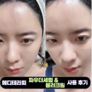 오메디업(주) | 메디테라피 파우더 세럼 블러크림 개봉기 | 사용 방법, 효과 정리