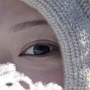 프로젝트 멍 | [내돈내산] 20대 눈밑지 후기(feat.직장인) / 1~5일차 멍•붓기•회복기간•병원