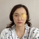 GS25순천향대병원점 | 순천향대 병원 백내장 수술 후기 (feat. 전신마취, 임신출산 이후)