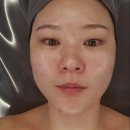 천곡주공4차아파트경로당 | 동해 피부관리 - 천곡동 에스테티아 동해 천곡 1호점 :: 윤곽관리로 매끈한 얼굴라인 만들기!