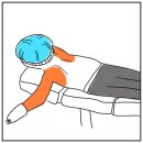 모짜르트치과의원 | 안양 팔뚝 지방추출주사 리얼 후기 (시술 당일, 1일차 겁나 자세함)