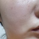 요즘 피부 푸석할 때 써본 골드손패치 겔마스크팩 (Gel Mask Pack) 솔직 후기