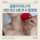 남3통 | 작영 셀룰라이트스틱 내돈내산 3통 사용후기 200% 활용법