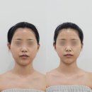 물오른피부 - 달서구 조암로 38 | 대구신부관리 물오른피부 신월성점, 윤곽관리 후기