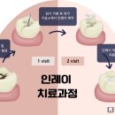 퍼즐치과기공소 이미지