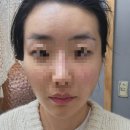 아로마천연제품 | ​[청주 가경동 피부관리] 더 예쁜 : 천연 아로마 동안 관리 후기