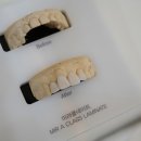 미라클치과기공소 이미지