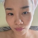충주호암동바이오포톤피부관리:) 라오르마