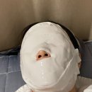 더블유피부과의원 | 삼성역피부과에서 올리지오리프팅 300샷 당일후기!
