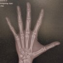 천안고든정형외과의원 | 우리 딸 첫 반깁스 경험기 [고든정형외과] 방문 후기